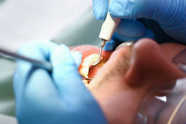 Best Cracked Tooth Emergency Dentist  in Richville, OH