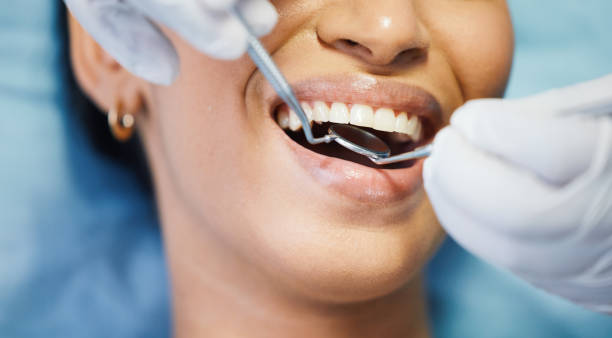 Best Urgent Tooth Repair  in Richville, OH